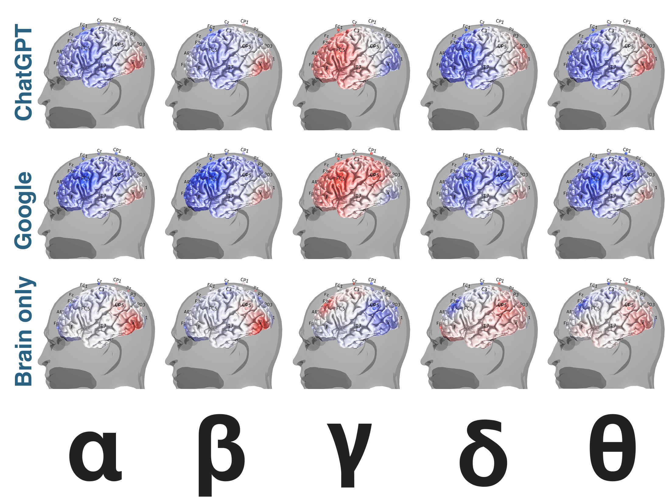 your brain on LLM